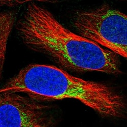 NDUFV3 Antibody, Novus Biologicals:Antibodies:Primary Antibodies